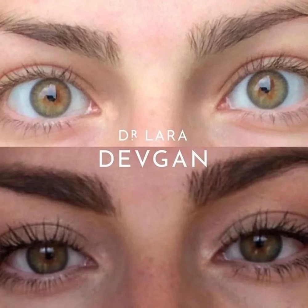 DR DEVGAN PLATINUM LONG LASH SERUM SCIENTIFIC BEAUTY VEGAN BEST MOST RESULTS NWT - Picture 8 of 14